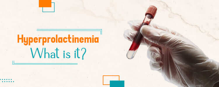 Hyperprolactinemia-What-is-it