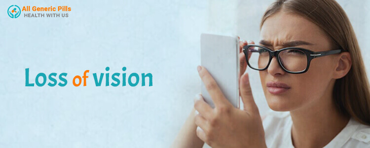 Loss of vision